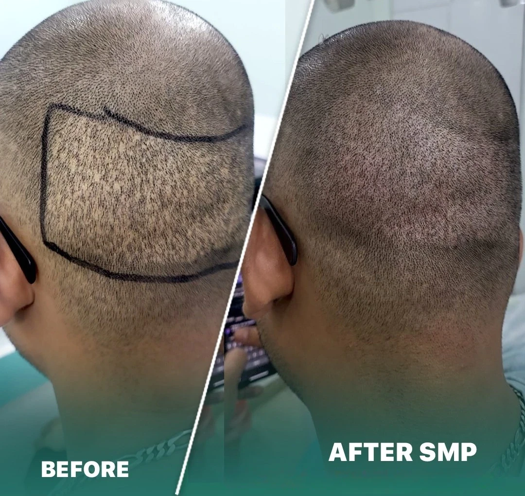 Pigmentation & Blemishes