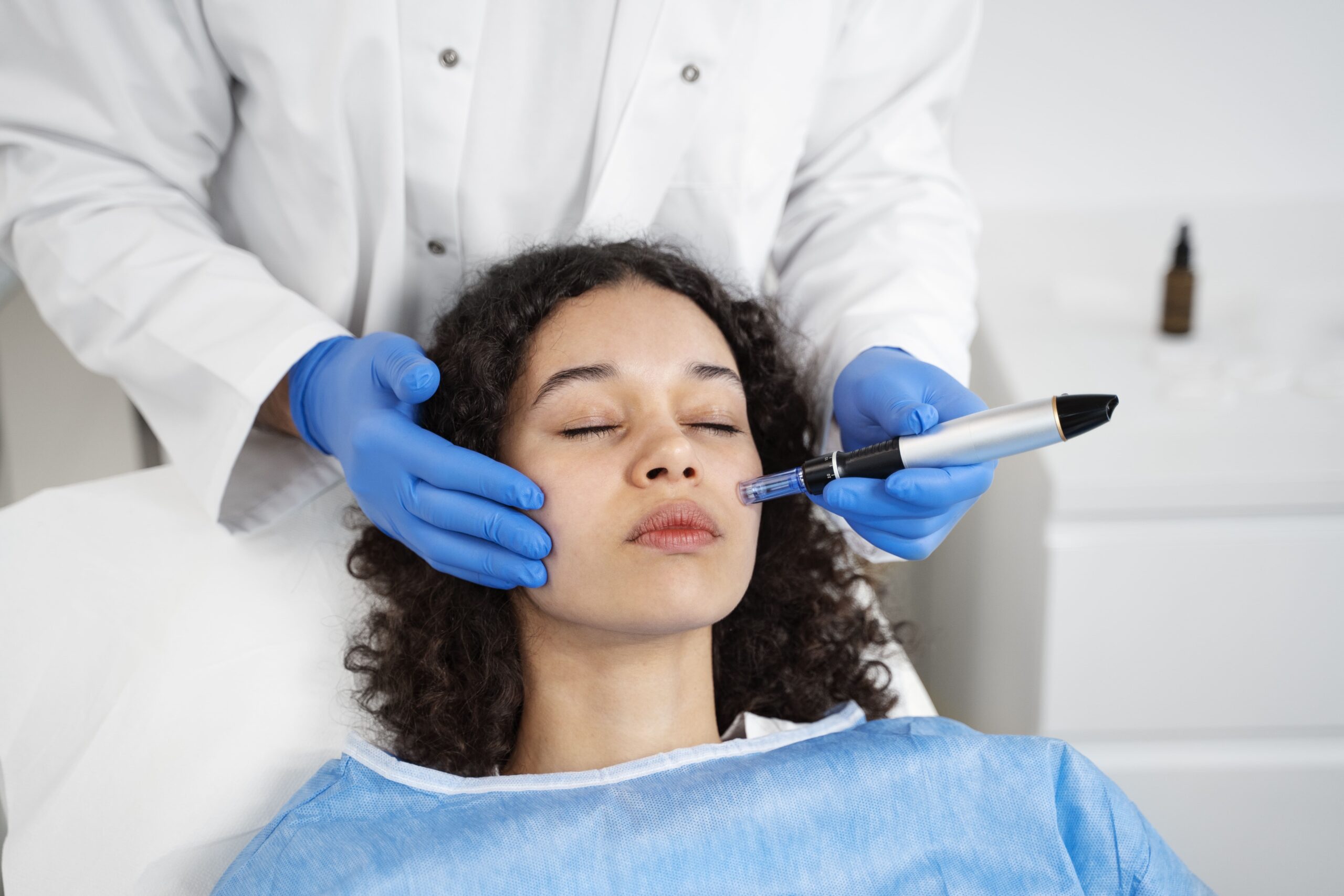 Chemical Peels