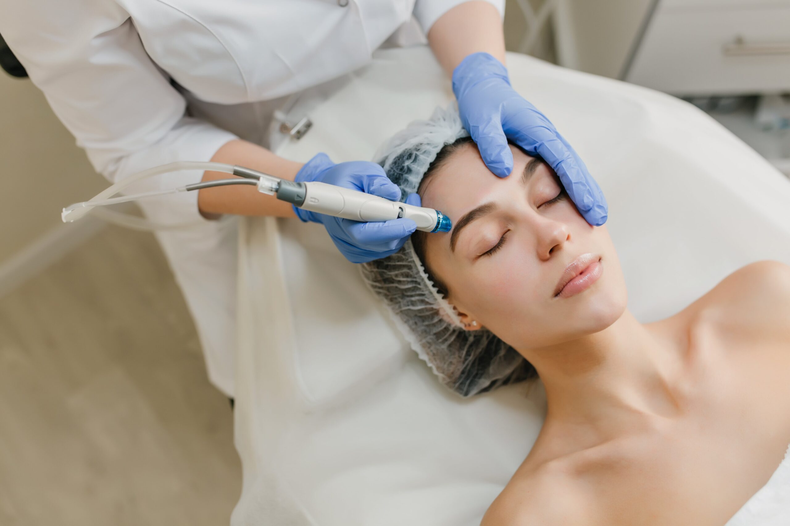 Chemical Peels